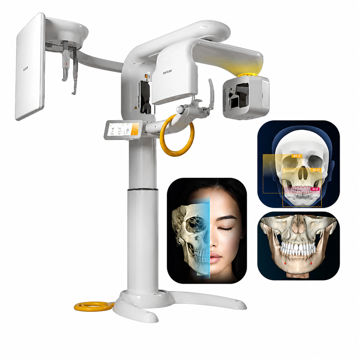 CBCT Machine